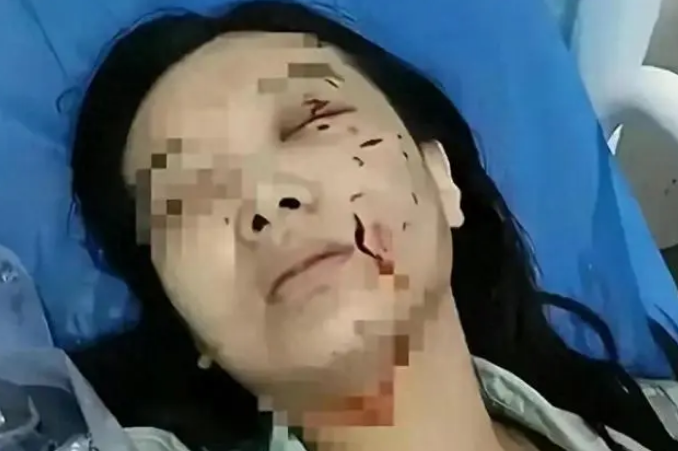 惹大了！松狮狗咬伤美少妇后续，狗主人可能面临800万天价赔偿