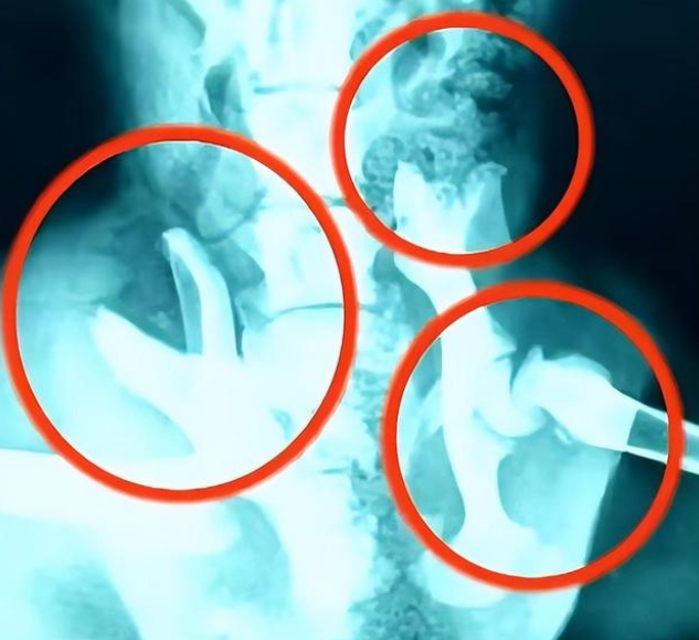 死去的狗狗从坟堆里爬了出来，靠坚强的意志爬行回家
