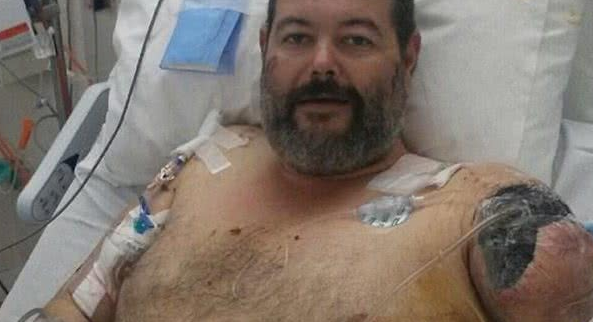 恶狗又伤人！澳洲男为客户修车惨遭2猎犬攻击，手臂被活生生撕掉