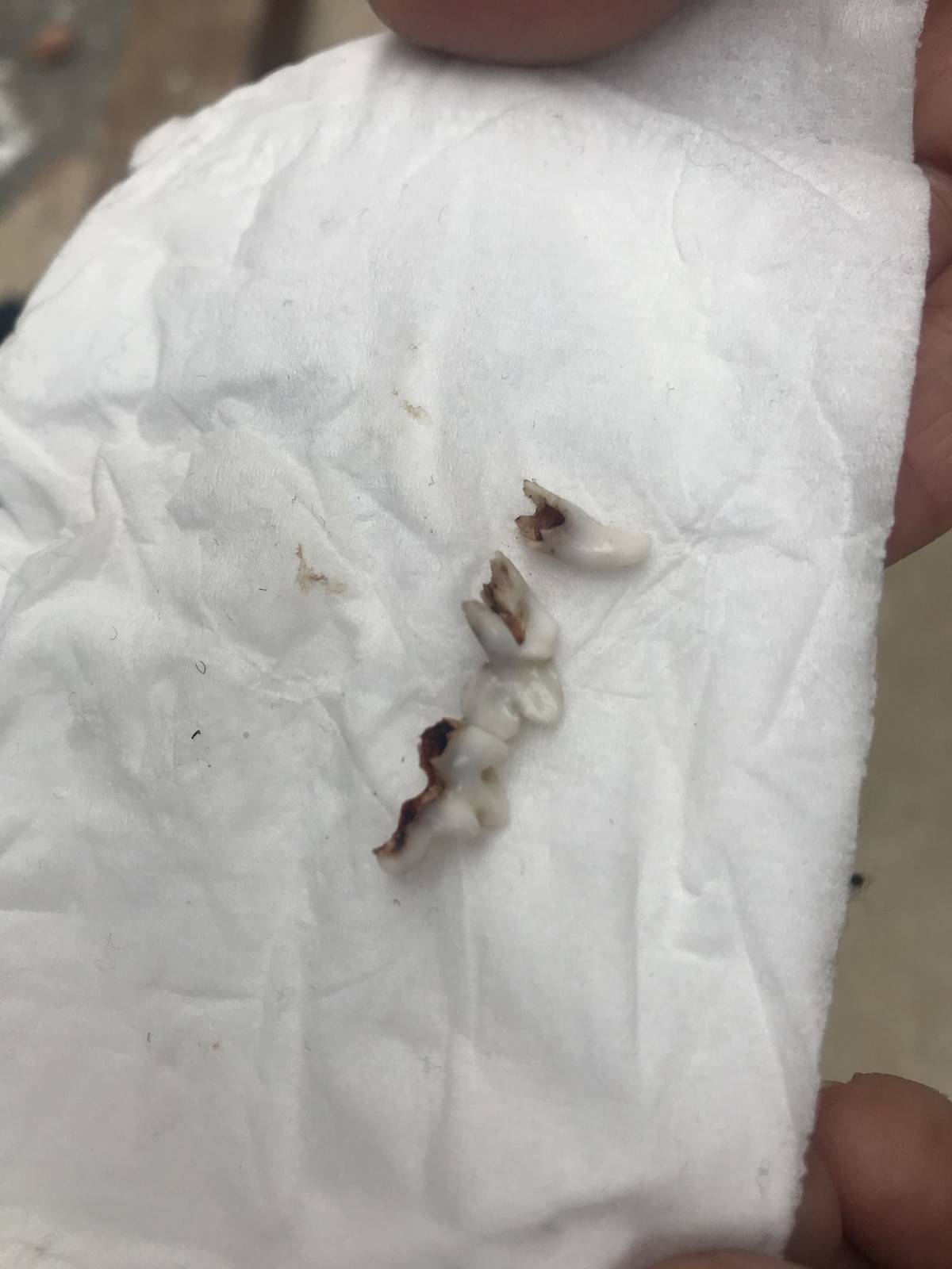 这是哪个帅哥的牙齿啊[偷笑][偷笑] 你们也会为你的宝贝留起乳齿吗[可爱]
